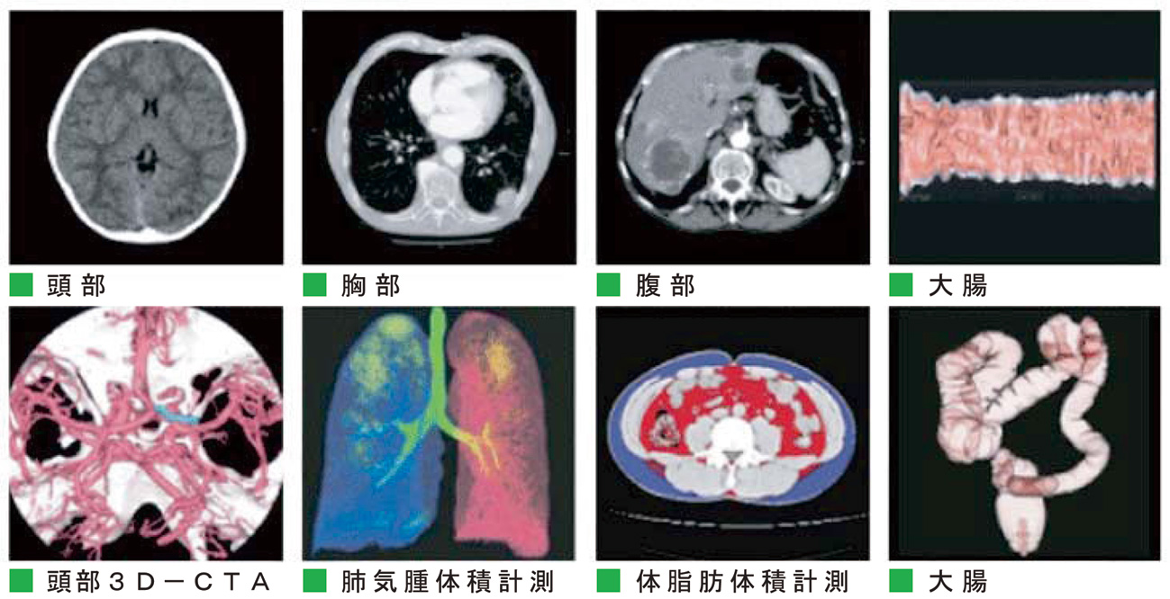 ＣＴスキャンで撮影した画像